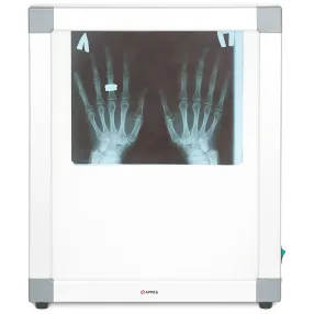 негатоскоп общего назначения 1-кадровый